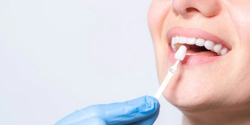 Teeth Whitening