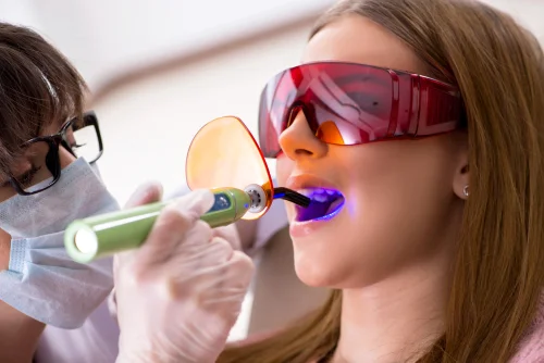 Composite Bonding